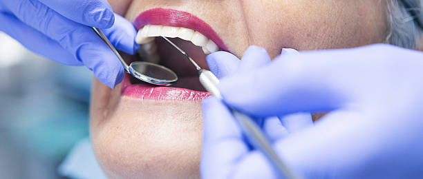 Best Emergency Tooth Extraction in Woodbury Heights, NJ